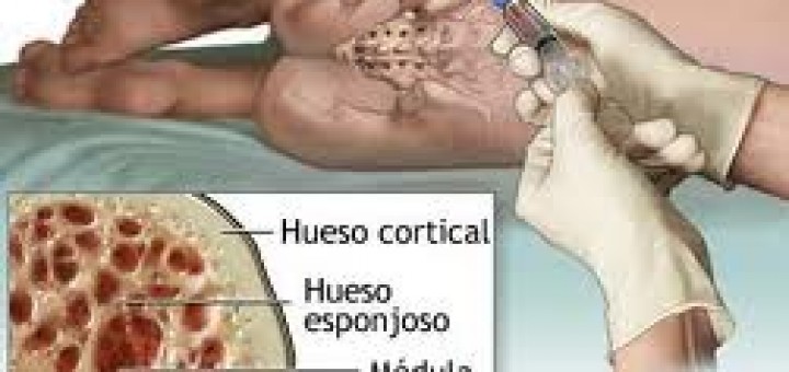 médula osea